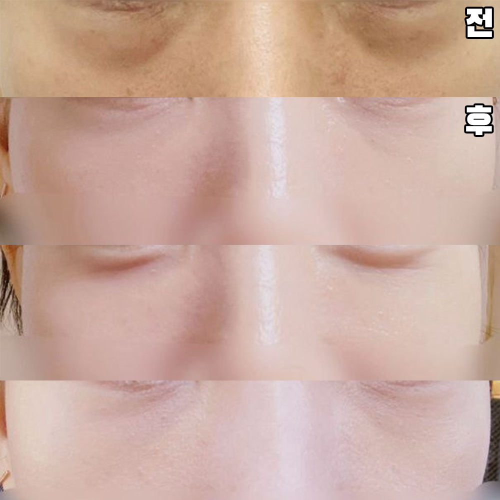 Цаг хугацаа өнгөрөх тусам илүү дээрдэхийг хүлээж байна.