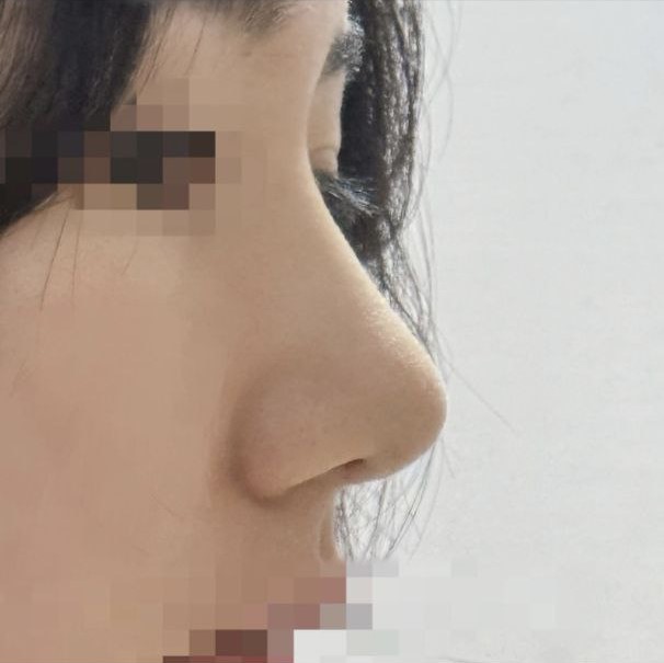 Хойшлуулсаар байгаад одоо л хийлгэсэн чинь эртхэн хийлгэх байж дээ ㅠㅠ