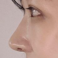 Гоё нүд, хамар хийлгэсэнд баярлалаа