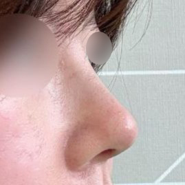 Би ч бас өмнөх болон дараах зургийн ялгааг хараад үнэхээр гайхсан шүү ㅎㅎ