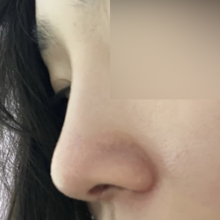 Би 7-р сарын эхээр Уиверсийн эмч Шим Жон Хванд хагалгаанд орсон!