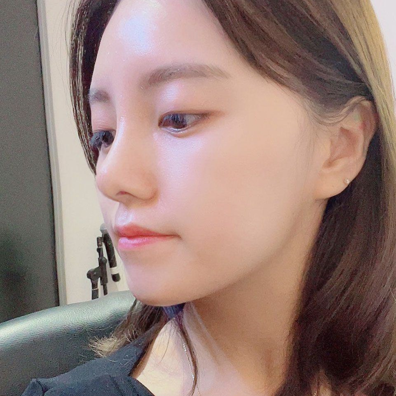 Виверс гоо сайхан мэс засал хийлгэснээс хойш 1 сар болж байна