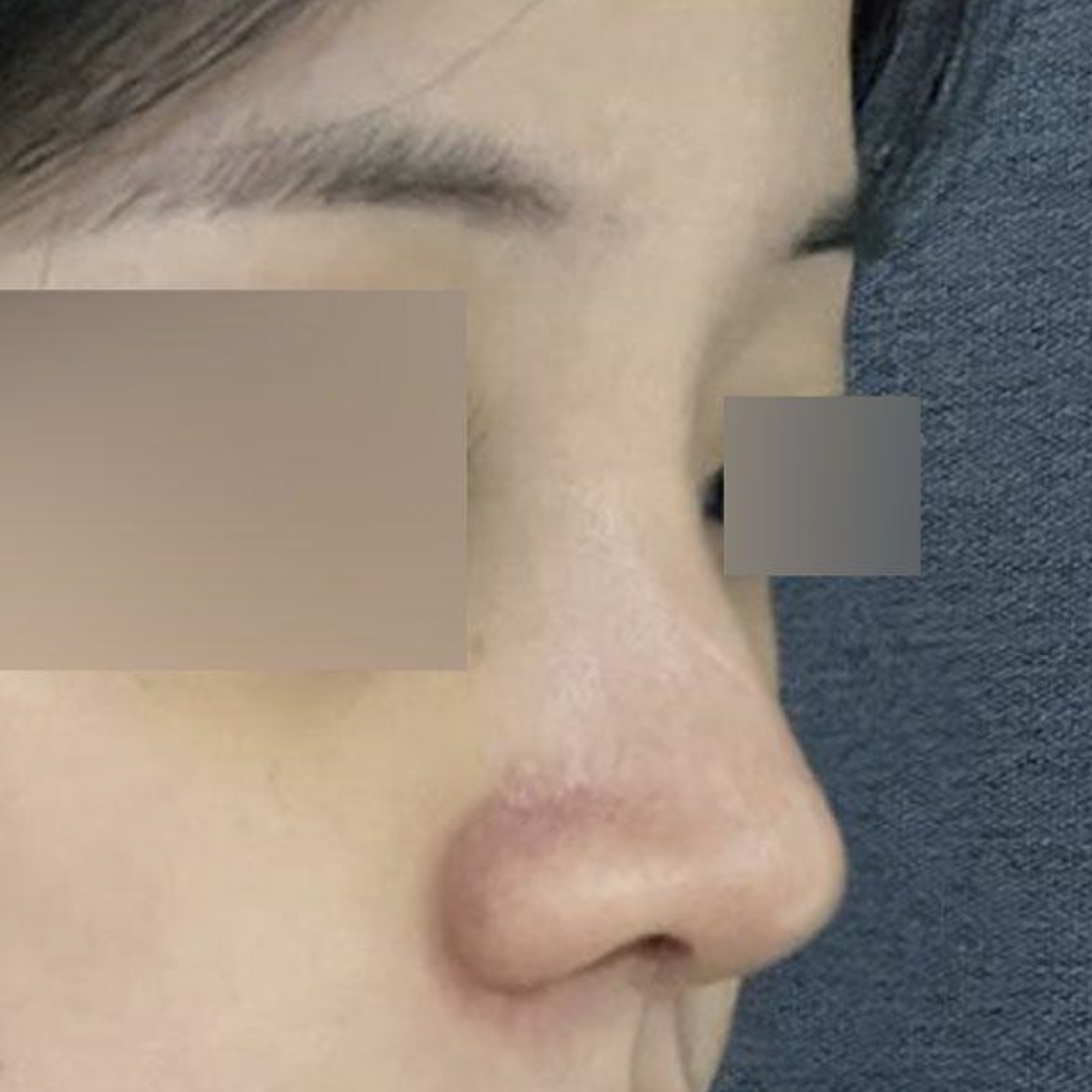 Мэс засал хийлгэснээс хойш 2 долоо хоног болж байна