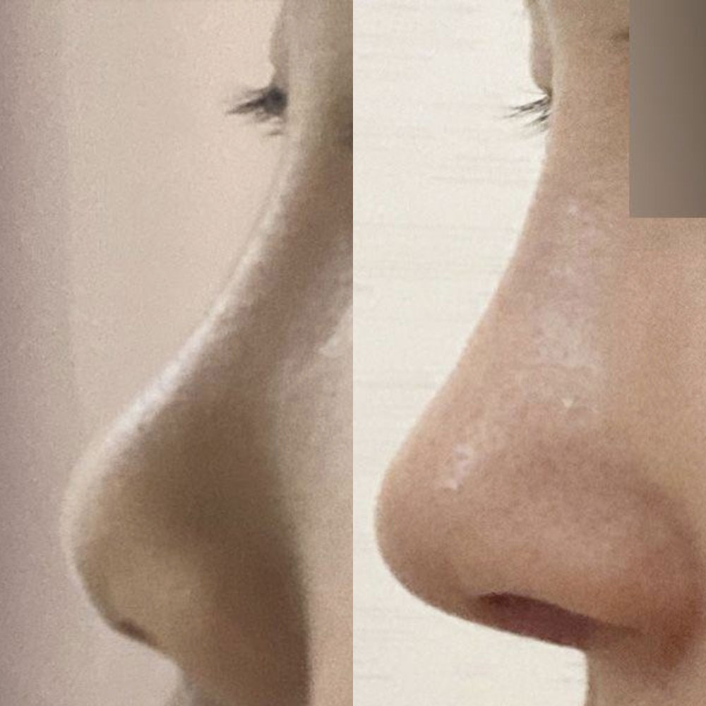 Би Сим Жон Хван эмчид хагалгаа хийлгэснээс хойш 2 долоо хоног болж байна.