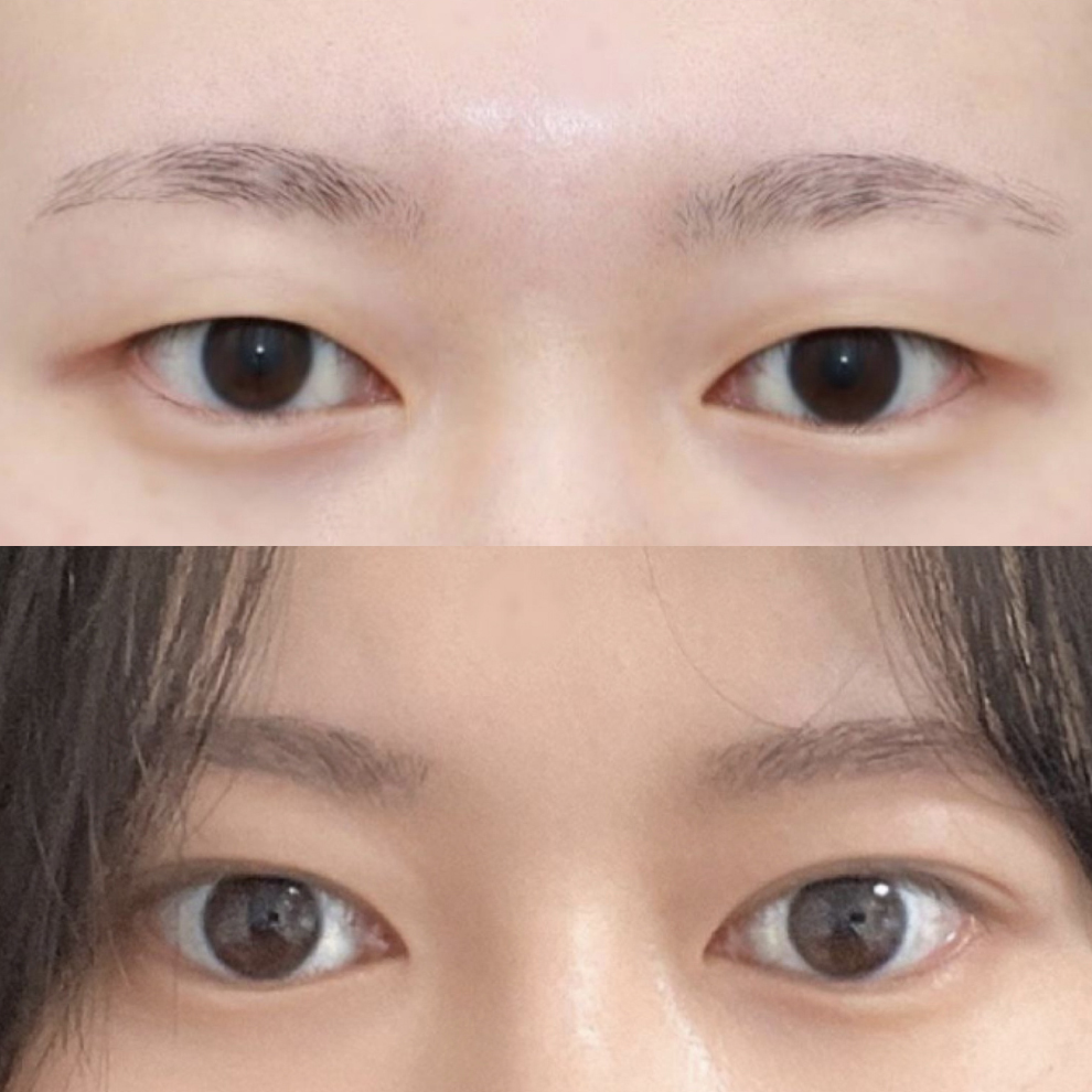 Мэс заслын дараах 3 сарын тойм