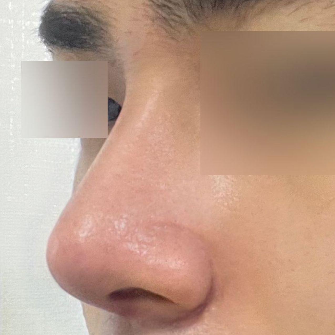 Виверс гоо сайхны мэс заслын эмнэлэгт хагалгаанд ороод 2 долоо хоног болж байна.