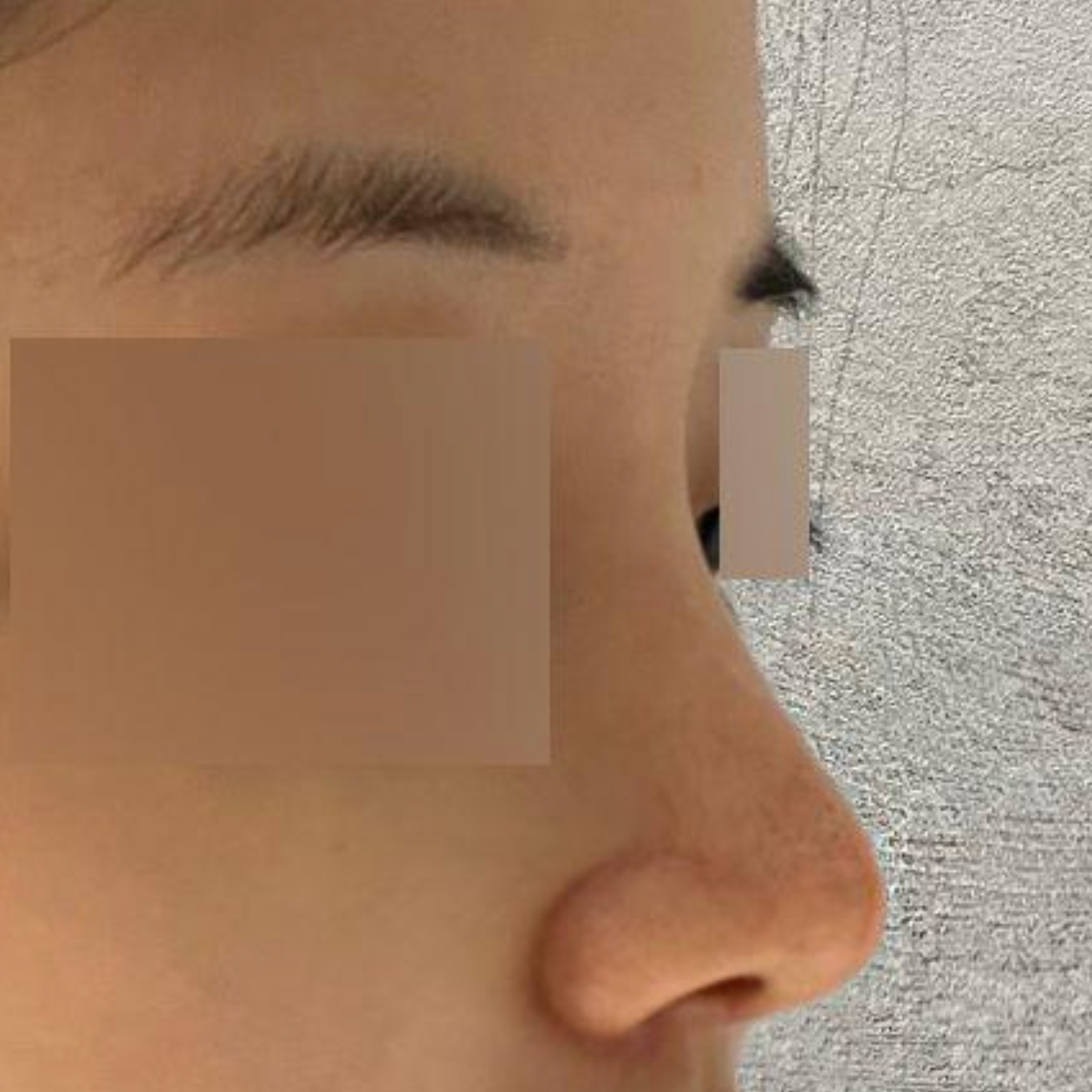 Мэс засал хийлгээд хоёр сар болж байна