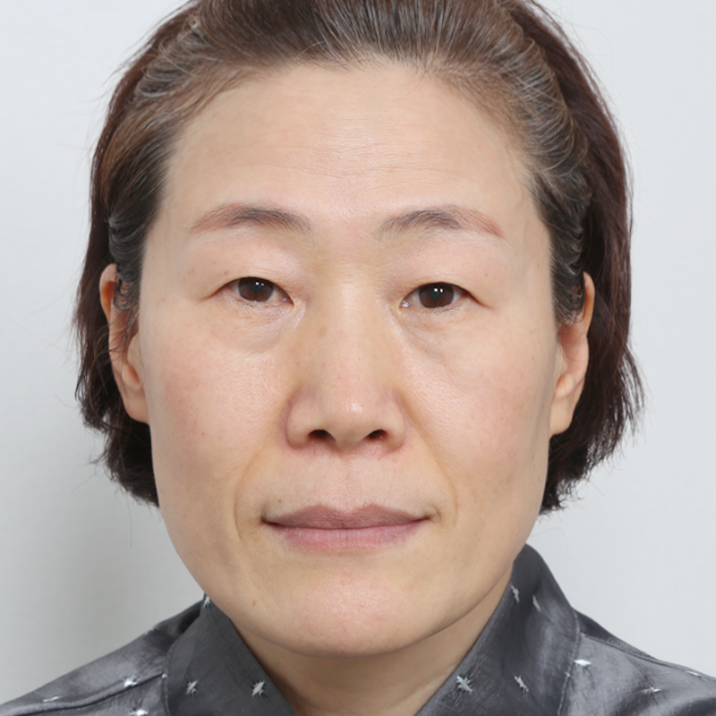 #Оёдолгүй(зүсэлтгүй) #Хойд, доод сэтэлгээ #Доод зовхи татах