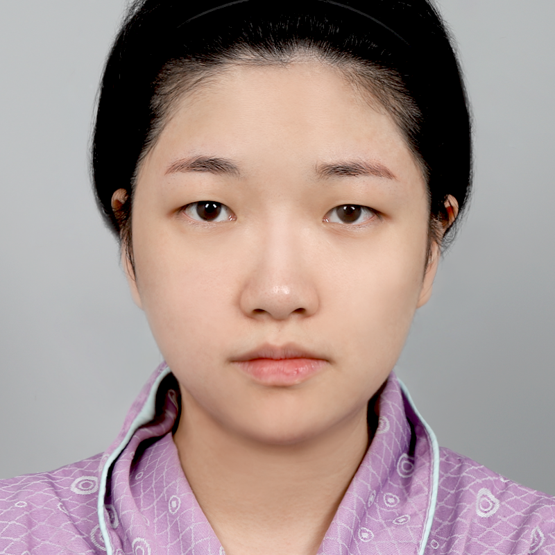 #Хамрын нуруу (силикон) #Хамрын үзүүр (өөрийн мөгөөрс) #Хэсэгчилсэн зүслэг #Нүдний хэлбэр засах #Дээд зовхины өөх зайлуулах