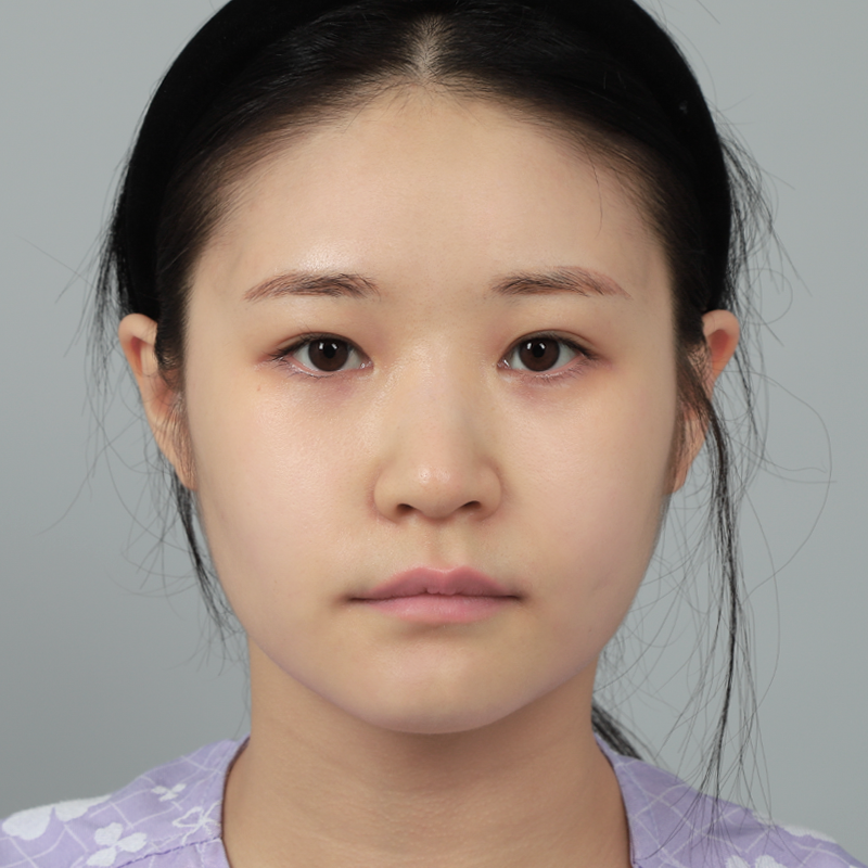 #Хамрын нуруу (силикон) #Хамрын үзүүр (өөрийн мөгөөрс)