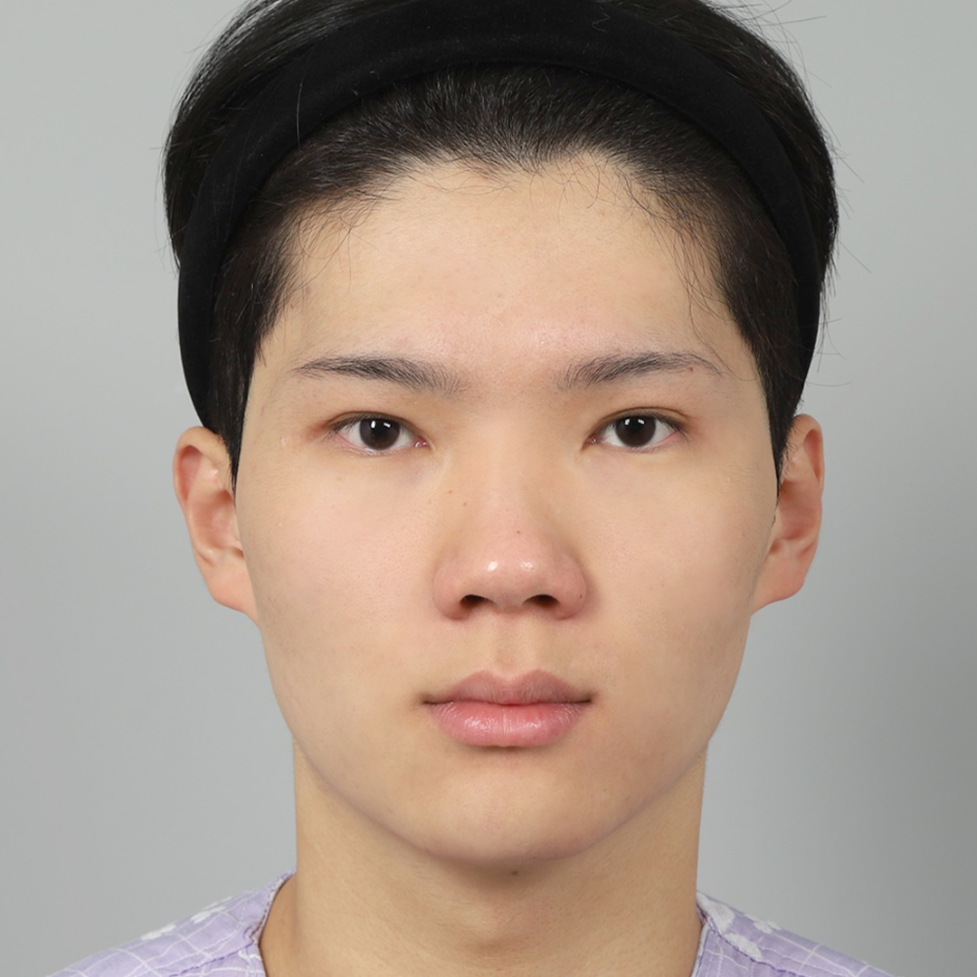 #Хамрын нуруу (силикон) #Хамрын үзүүр (өөрийн мөгөөрс)