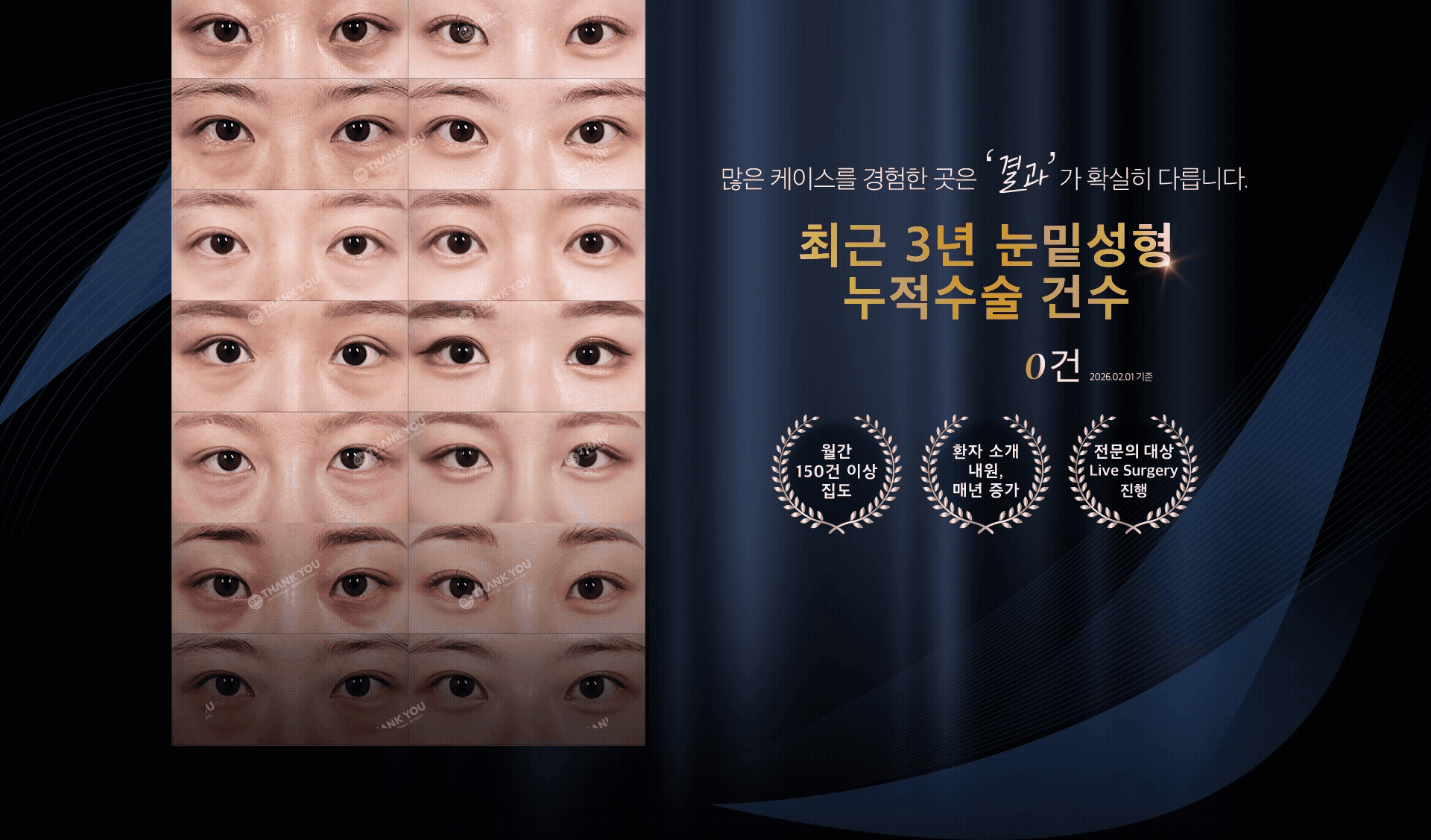 Thank You гоо сайхны мэс засал - Зураг 13